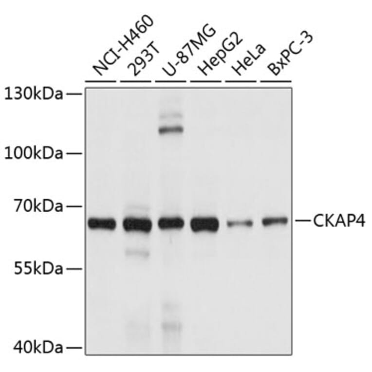 Western Blot - Anti-CKAP4 Antibody (A4468) - Antibodies.com