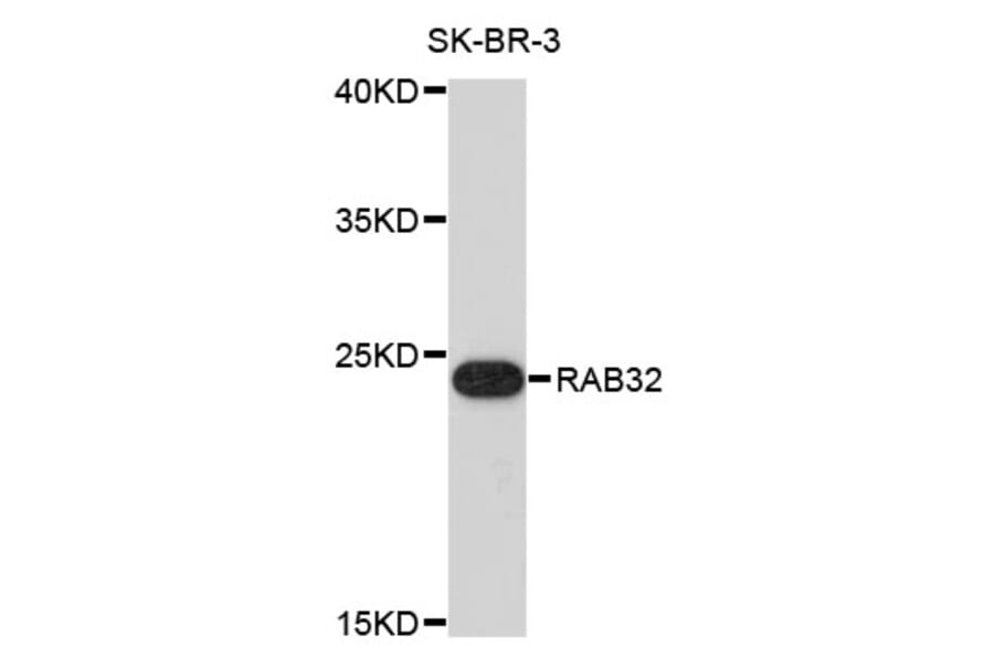 Western Blot - Anti-RAB32 Antibody (A4470) - Antibodies.com