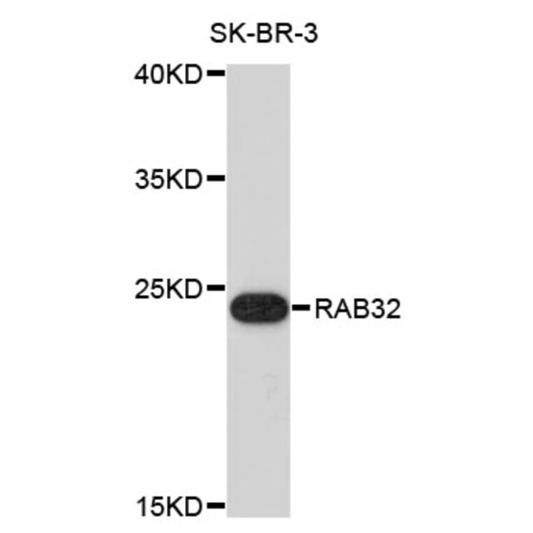 Western Blot - Anti-RAB32 Antibody (A4470) - Antibodies.com