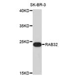 Western Blot - Anti-RAB32 Antibody (A4470) - Antibodies.com