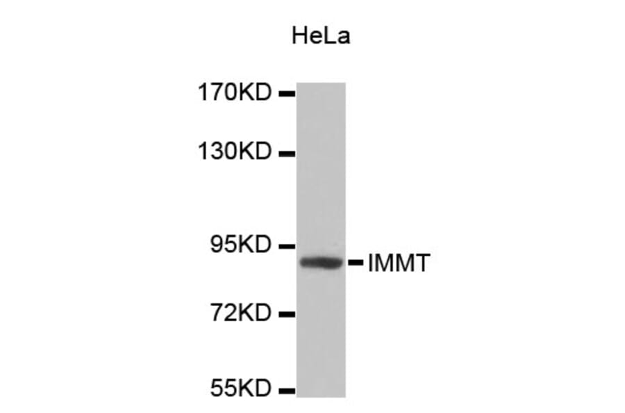 Western Blot - Anti-IMMT Antibody (A4471) - Antibodies.com