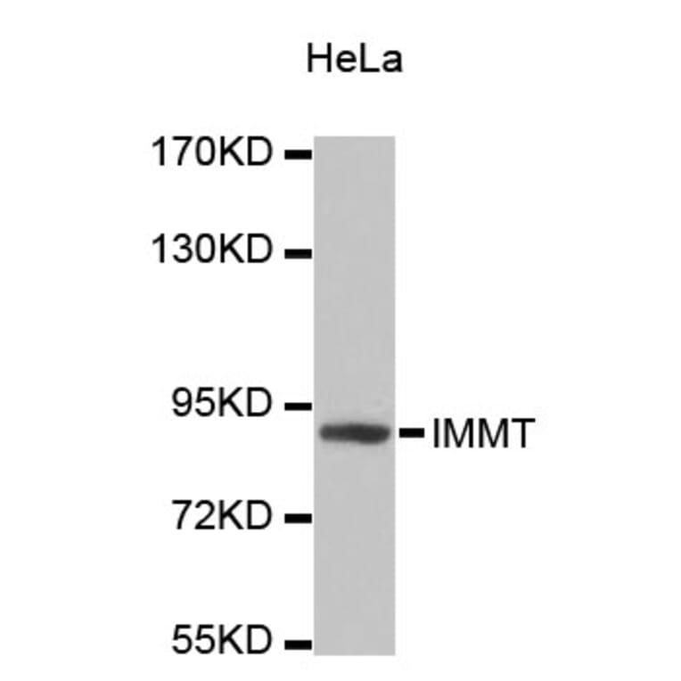 Western Blot - Anti-IMMT Antibody (A4471) - Antibodies.com