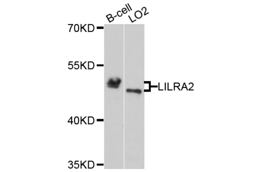 Western Blot - Anti-LILRA2 Antibody (A4477) - Antibodies.com