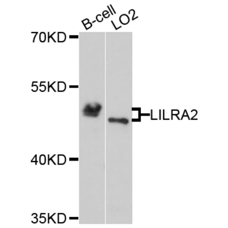 Western Blot - Anti-LILRA2 Antibody (A4477) - Antibodies.com