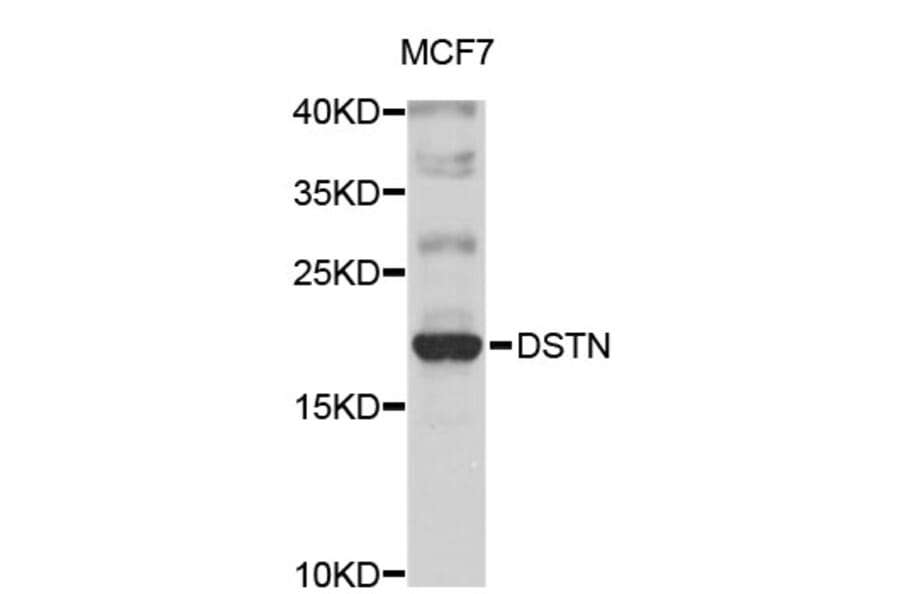 Western Blot - Anti-DSTN Antibody (A4480) - Antibodies.com