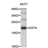 Western Blot - Anti-DSTN Antibody (A4480) - Antibodies.com