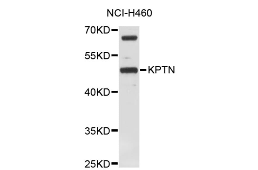 Western Blot - Anti-KPTN Antibody (A4490) - Antibodies.com