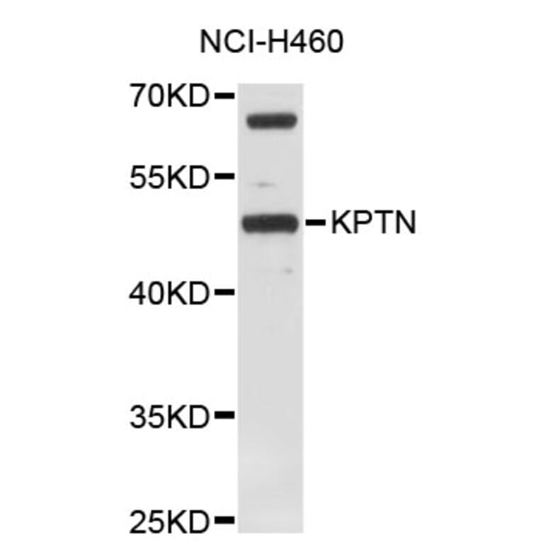 Western Blot - Anti-KPTN Antibody (A4490) - Antibodies.com