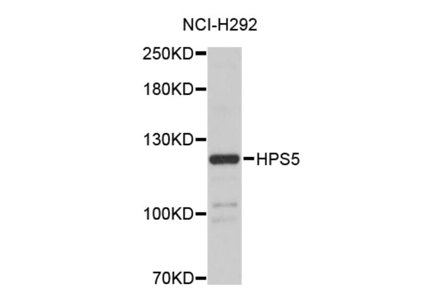 Western Blot - Anti-HPS5 Antibody (A4494) - Antibodies.com