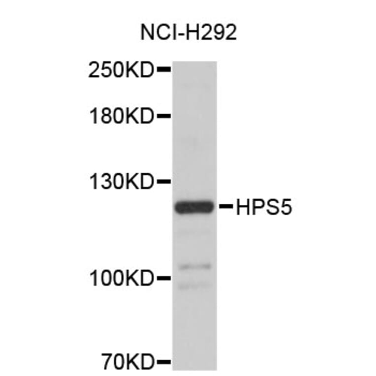 Western Blot - Anti-HPS5 Antibody (A4494) - Antibodies.com