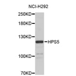 Western Blot - Anti-HPS5 Antibody (A4494) - Antibodies.com
