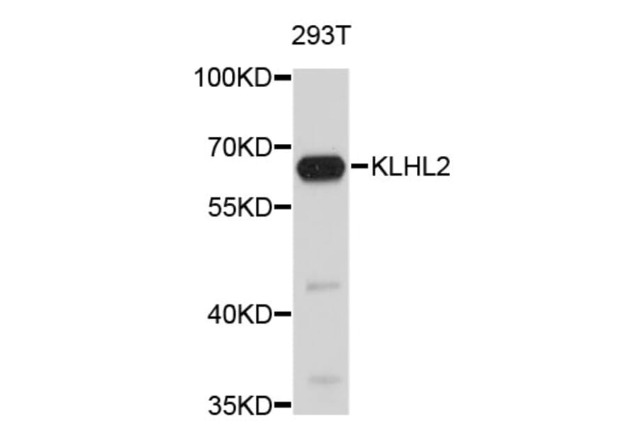 Western Blot - Anti-KLHL2 Antibody (A4498) - Antibodies.com