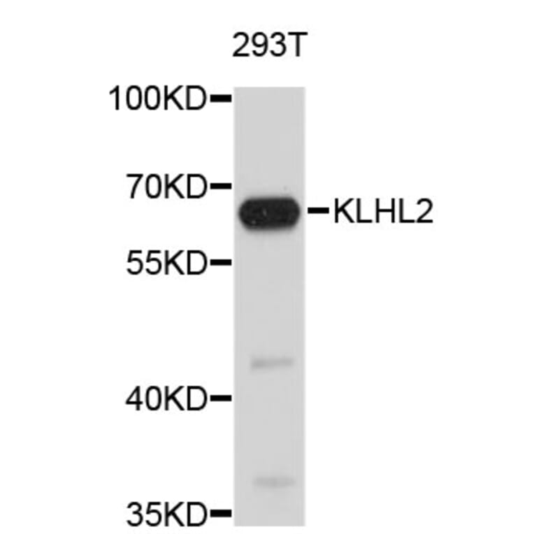 Western Blot - Anti-KLHL2 Antibody (A4498) - Antibodies.com