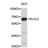 Western Blot - Anti-KLHL2 Antibody (A4498) - Antibodies.com