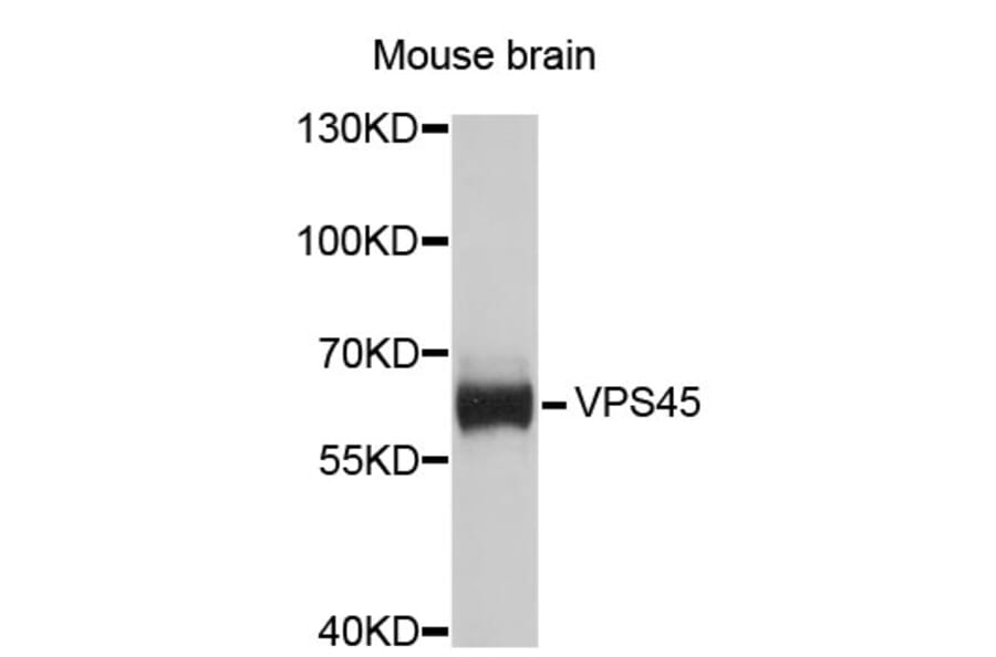 Western Blot - Anti-VPS45 Antibody (A4501) - Antibodies.com