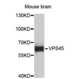 Western Blot - Anti-VPS45 Antibody (A4501) - Antibodies.com