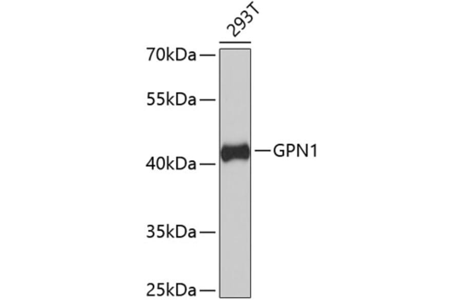 Western Blot - Anti-GPN1 Antibody (A4503) - Antibodies.com