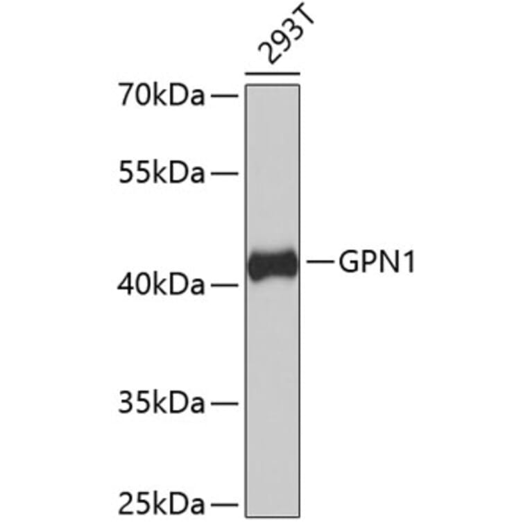 Western Blot - Anti-GPN1 Antibody (A4503) - Antibodies.com