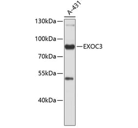 Western Blot - Anti-rSec6 Antibody (A9483) - Antibodies.com