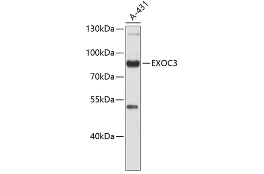 Western Blot - Anti-rSec6 Antibody (A9483) - Antibodies.com