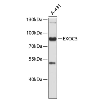 Western Blot - Anti-rSec6 Antibody (A9483) - Antibodies.com