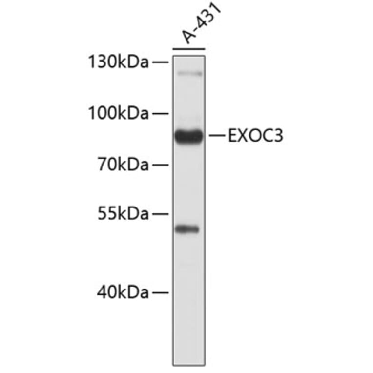Western Blot - Anti-rSec6 Antibody (A9483) - Antibodies.com
