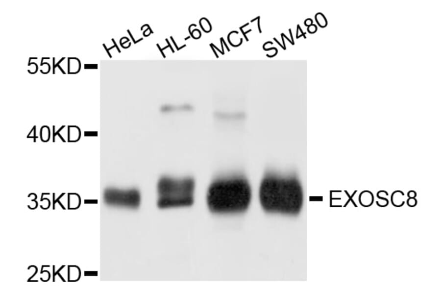Western Blot - Anti-EXOSC8 Antibody (A4507) - Antibodies.com