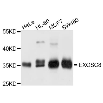 Western Blot - Anti-EXOSC8 Antibody (A4507) - Antibodies.com