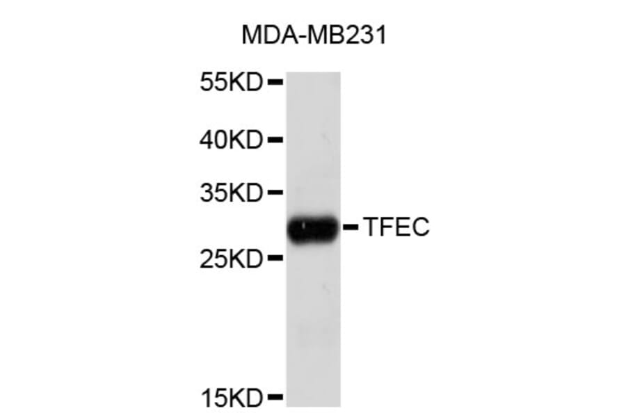 Western Blot - Anti-TFEC Antibody (A4508) - Antibodies.com