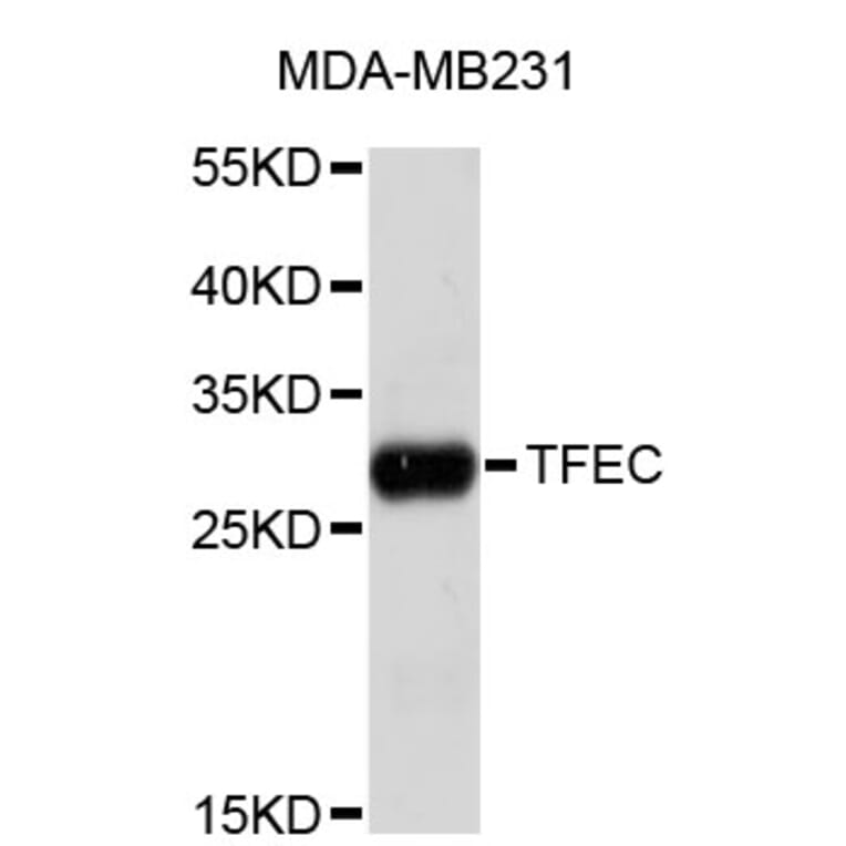 Western Blot - Anti-TFEC Antibody (A4508) - Antibodies.com