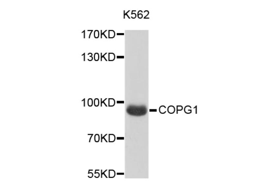 Western Blot - Anti-COPG1 Antibody (A4510) - Antibodies.com