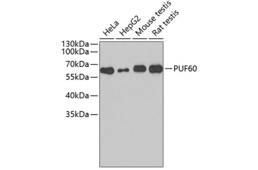 Western Blot - Anti-PUF60 Antibody (A4511) - Antibodies.com