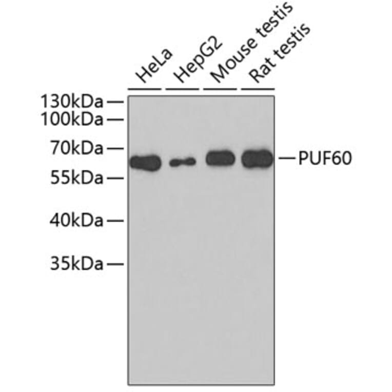 Western Blot - Anti-PUF60 Antibody (A4511) - Antibodies.com