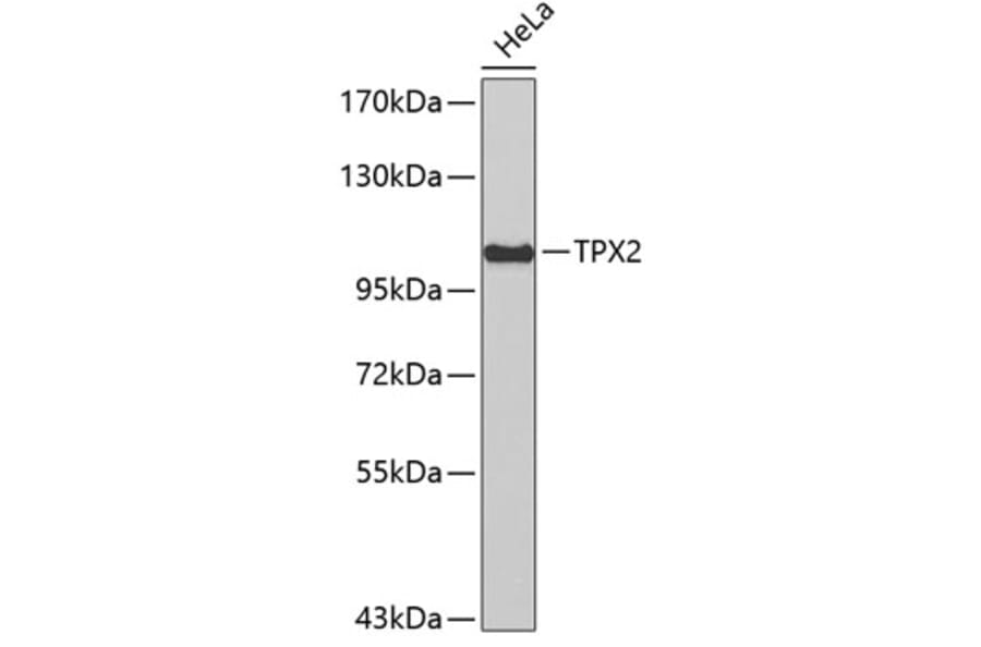 Western Blot - Anti-TPX2 Antibody (A4522) - Antibodies.com