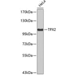 Western Blot - Anti-TPX2 Antibody (A4522) - Antibodies.com