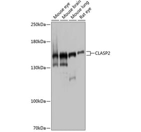 Western Blot - Anti-CLASP2 Antibody (A9490) - Antibodies.com