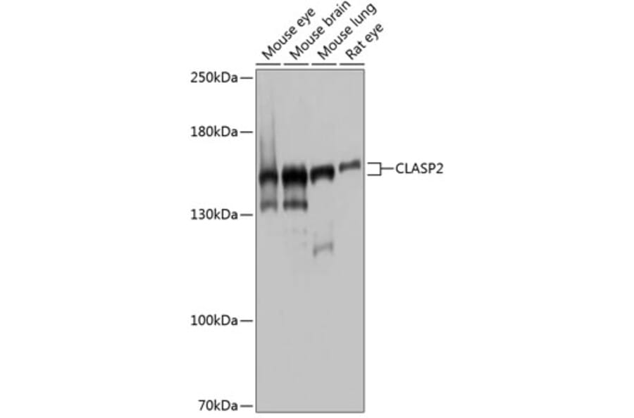 Western Blot - Anti-CLASP2 Antibody (A9490) - Antibodies.com