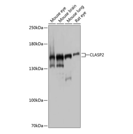 Western Blot - Anti-CLASP2 Antibody (A9490) - Antibodies.com
