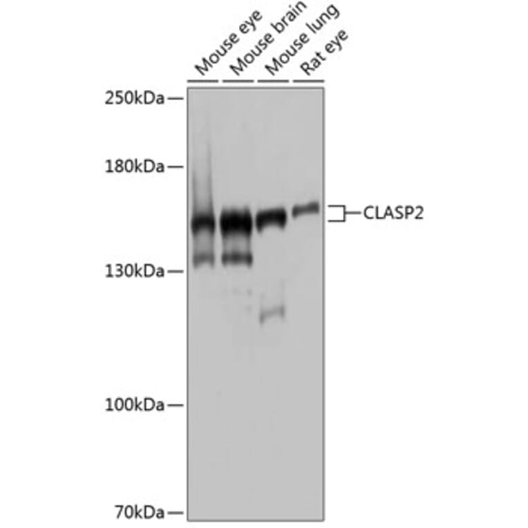 Western Blot - Anti-CLASP2 Antibody (A9490) - Antibodies.com