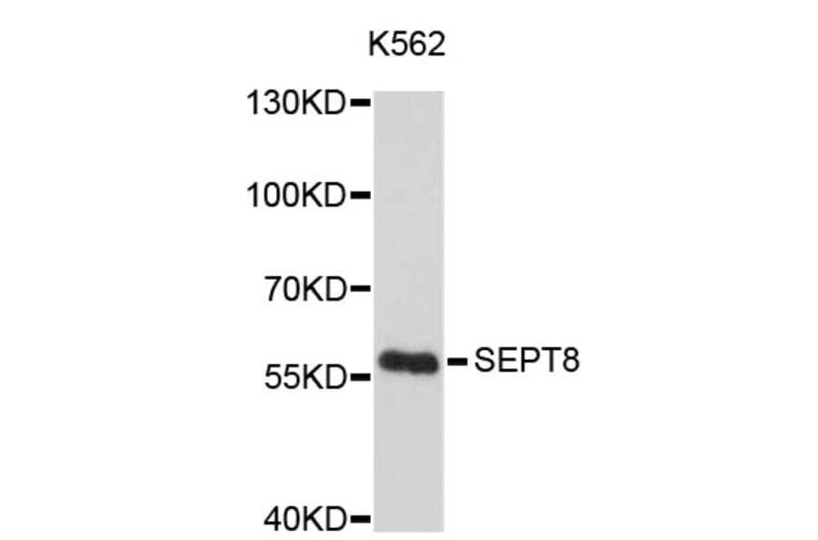 Western Blot - Anti-SEPT8 Antibody (A4531) - Antibodies.com
