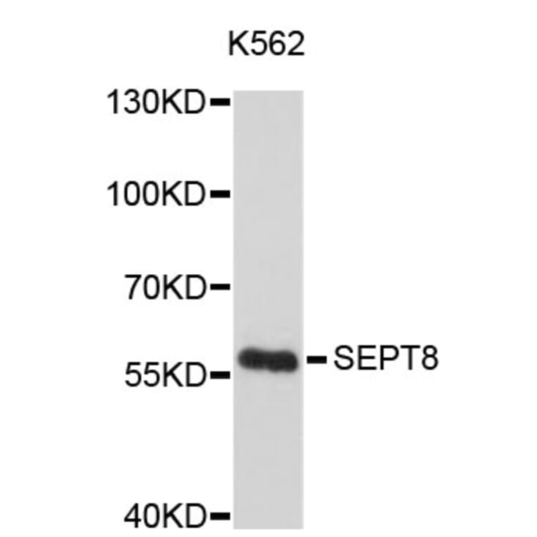 Western Blot - Anti-SEPT8 Antibody (A4531) - Antibodies.com