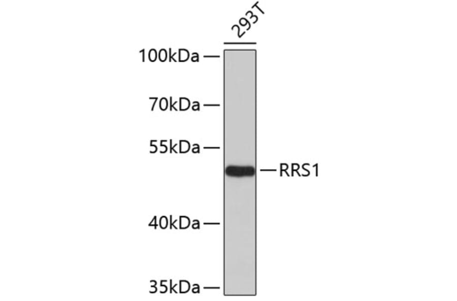 Western Blot - Anti-RRS1 Antibody (A4536) - Antibodies.com