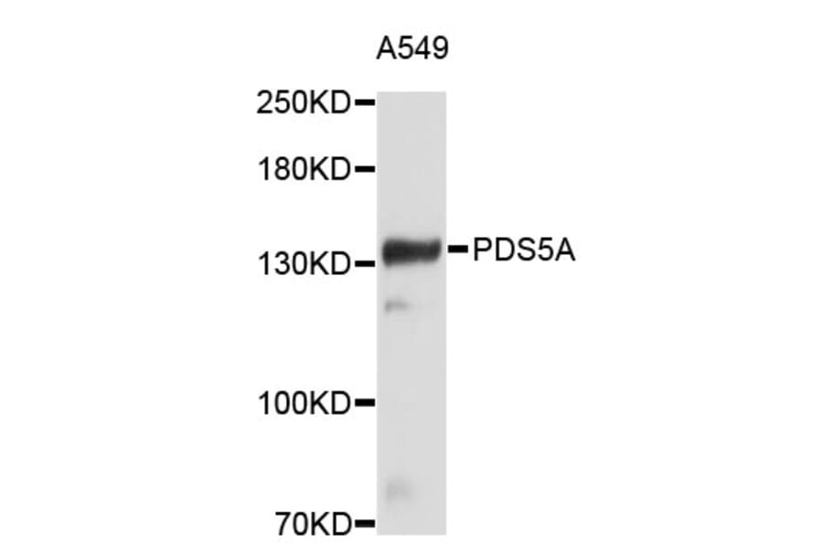 Western Blot - Anti-PDS5A Antibody (A4537) - Antibodies.com