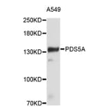 Western Blot - Anti-PDS5A Antibody (A4537) - Antibodies.com