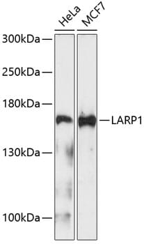 Western blot analysis of extracts of various cell lines, using Anti-LARP1 Antibody (A4543) at 1:1,000 dilution.
Secondary antibody: Goat Anti-Rabbit IgG (H+L) (HRP) (AS014) at 1:10,000 dilution.
Lysates / proteins: 25µg per lane.
Blocking buffer: 3% non-fat dry milk in TBST.
Detection: ECL Basic Kit (RM00020).
Exposure time: 90s.