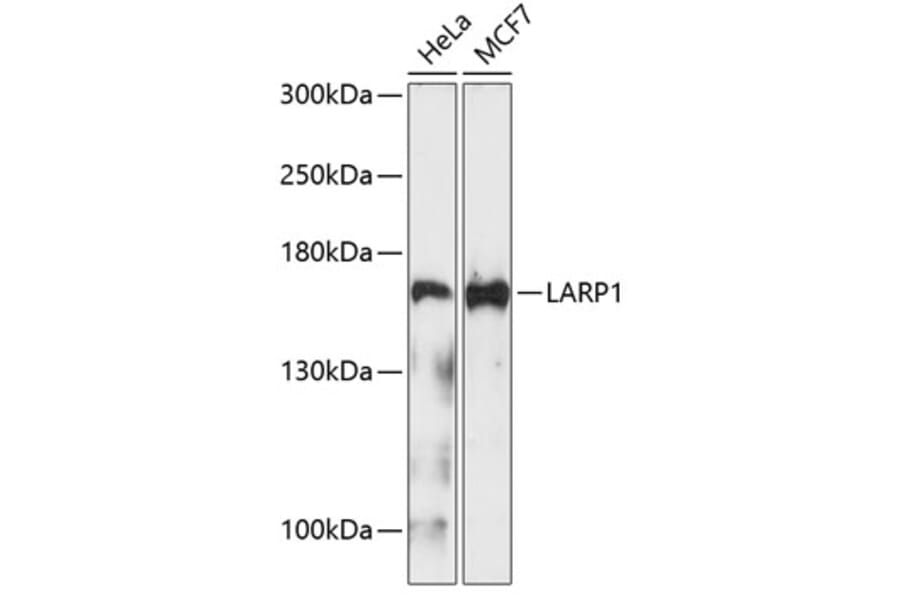 Western Blot - Anti-LARP1 Antibody (A9495) - Antibodies.com