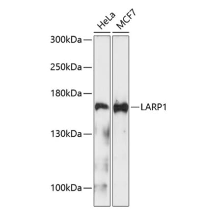 Western Blot - Anti-LARP1 Antibody (A9495) - Antibodies.com
