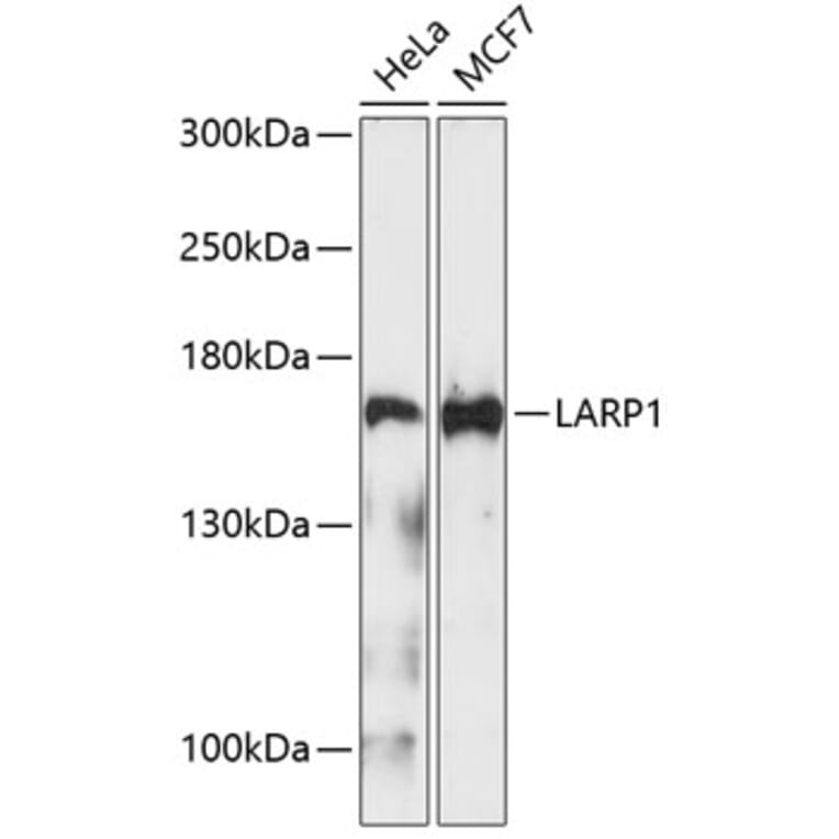 Western Blot - Anti-LARP1 Antibody (A9495) - Antibodies.com