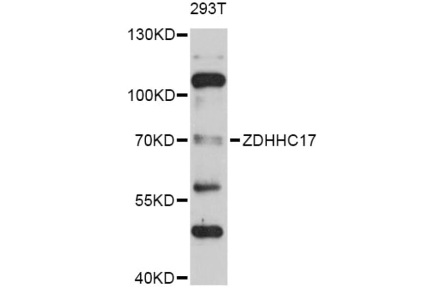 Western Blot - Anti-ZDHHC17 Antibody (A4545) - Antibodies.com