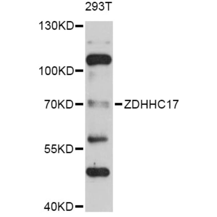 Western Blot - Anti-ZDHHC17 Antibody (A4545) - Antibodies.com